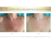 Isdin Glicoisdin Intense - Image 2