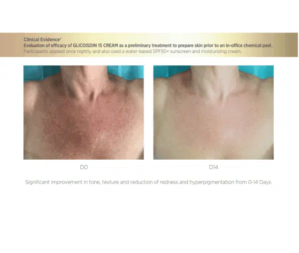 Isdin Glicoisdin Intense - Image 2