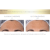 Isdin Glicoisdin Intense - Image 3