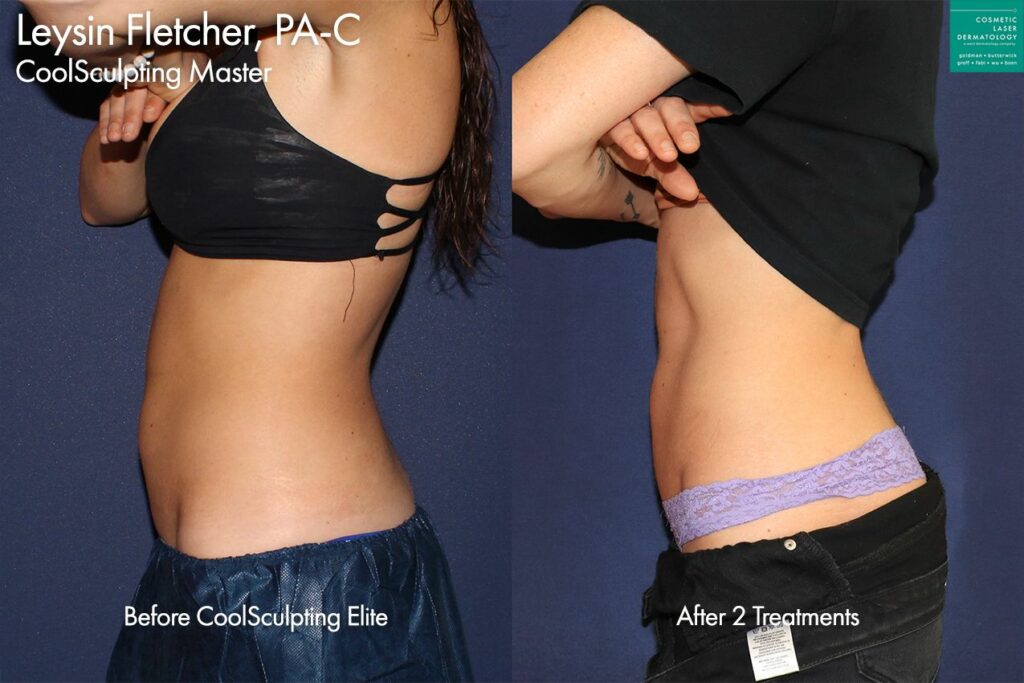 Body Contouring Procedures San Diego, Medical Spa