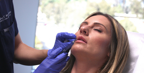 patient receiving dermal filler injections in San Diego, CA