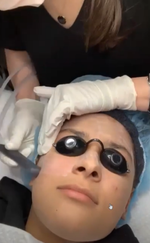 patient receiving a SaltFacial from an aesthetician at CLDerm in San Diego