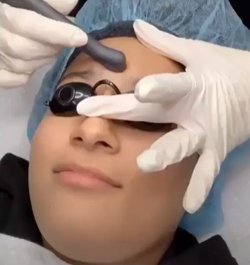 patient receiving a SaltFacial from an aesthetician at CLDerm in San Diego