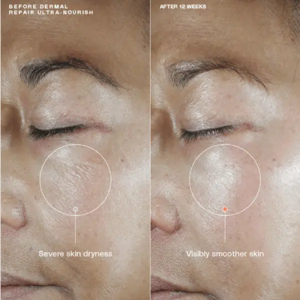 Senté Dermal Repair Ultra-Nourish - Image 2