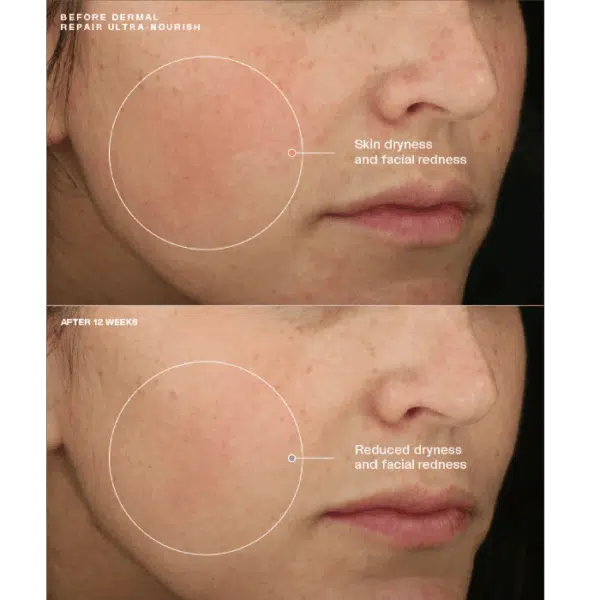 Senté Dermal Repair Ultra-Nourish - Image 3