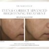 SkinMedica Even & Correct Advanced Brightening Treatment - Image 4