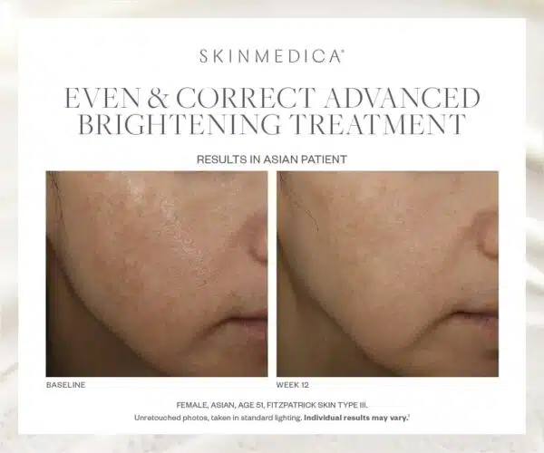 SkinMedica Even & Correct Advanced Brightening Treatment - Image 4