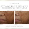 SkinMedica Even & Correct Advanced Brightening Treatment - Image 3