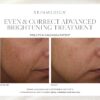 SkinMedica Even & Correct Advanced Brightening Treatment - Image 2