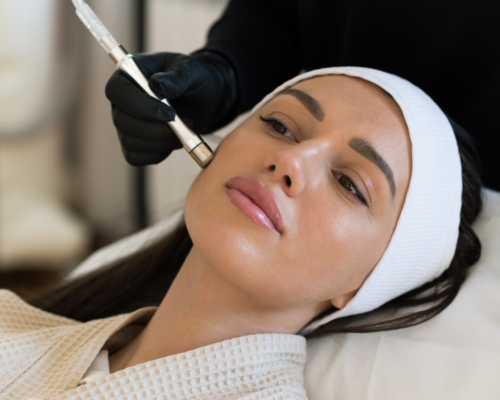 clderm microdermabrasion treatment on patient in san diego ca