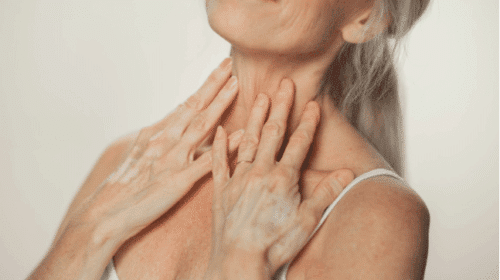 chest wrinkles treatment clderm san diego