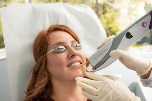 patient receiving laser skin resurfacing in San DIego