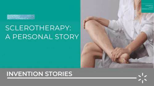 sclerotherapy a personal journey