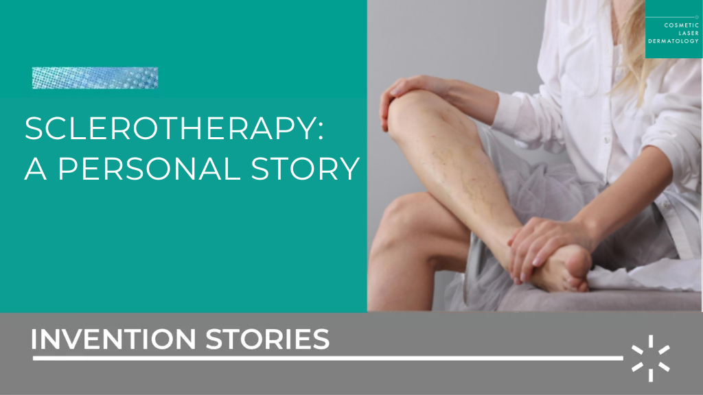 sclerotherapy a personal journey