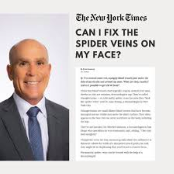 Dr Mitchel Goldman The New York Times article about spider veins on face