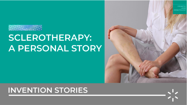 sclerotherapy a personal journey