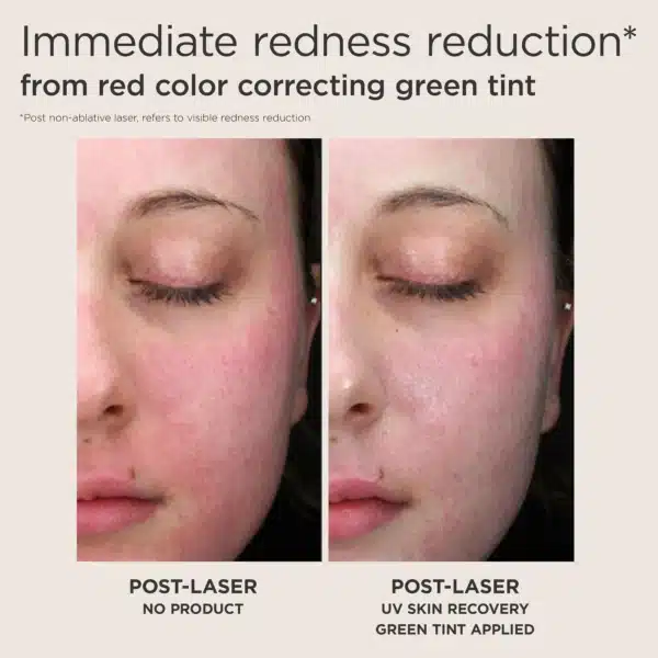 EltaMD UV Skin Recovery Red Color Correcting Green Tint Broad Spectrum SPF 50 - Image 6