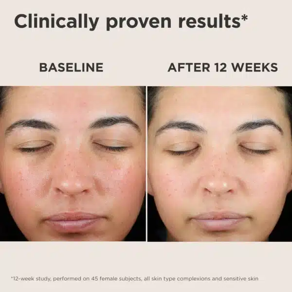 EltaMD UV Skin Recovery Red Color Correcting Green Tint Broad Spectrum SPF 50 - Image 7