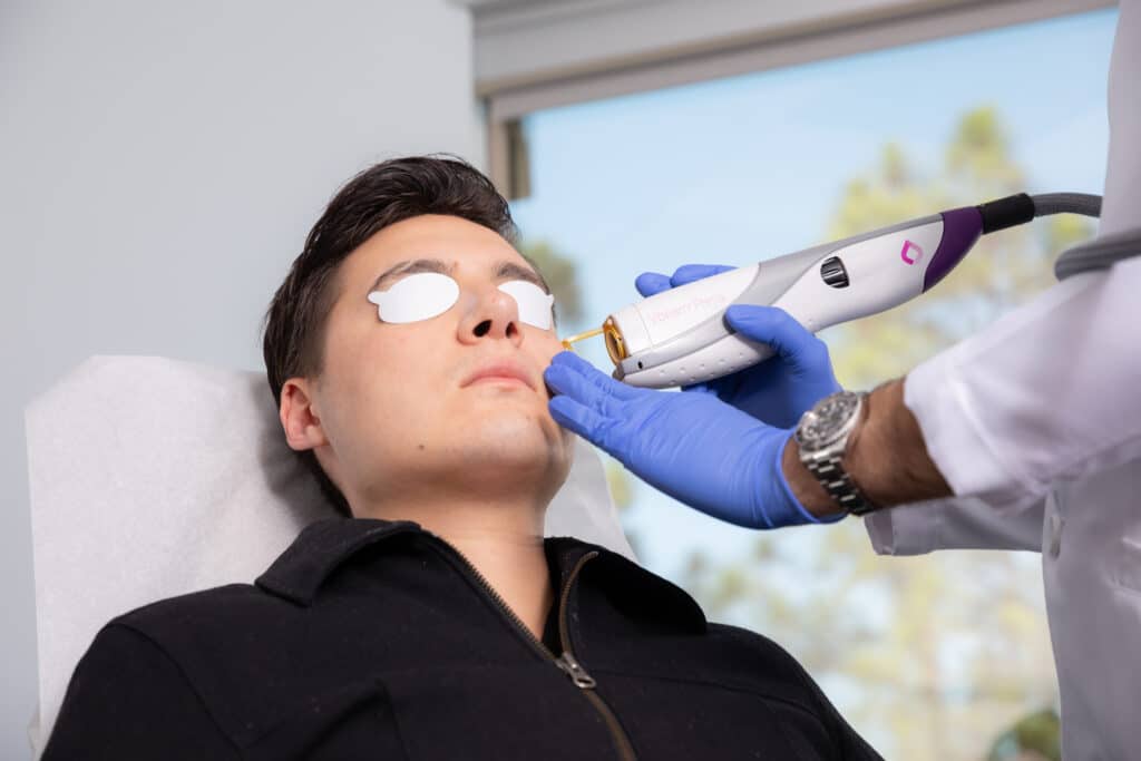 patient receiving laser treatment on face