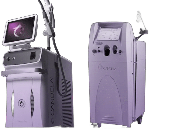 candela vbeam pro laser device